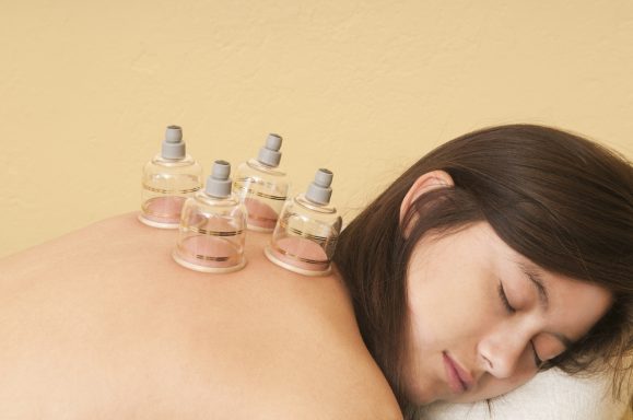 Dry Cupping Therapy