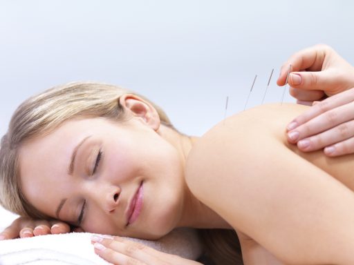 Dry needling therapy